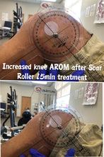 Load image into Gallery viewer, The Scar Roller - Pain Management Device
